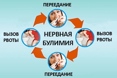 Лечение булимии в Кировске